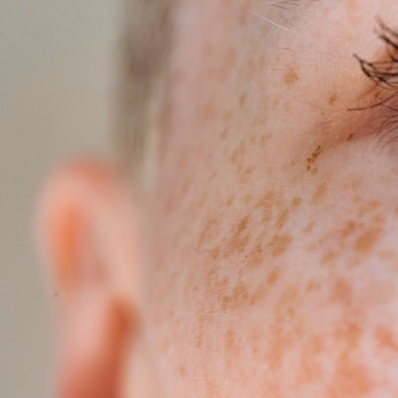 Shea Butter Shop - acne prone skin